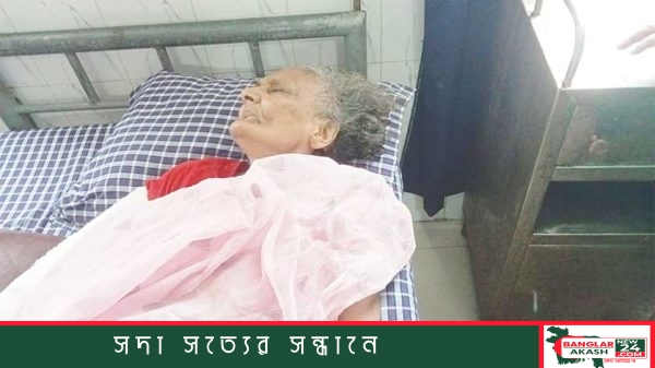 বগুড়ার শিবগঞ্জে সড়ক দুর্ঘটনার স্থান এবং আহত জনপ্রশাসন ও খাদ্য প্রতিমন্ত্রী আব্দুল বারীর ছবি।